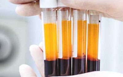 Beneath the Surface: Exploring the benefits of Platelet Rich Plasma Treatment